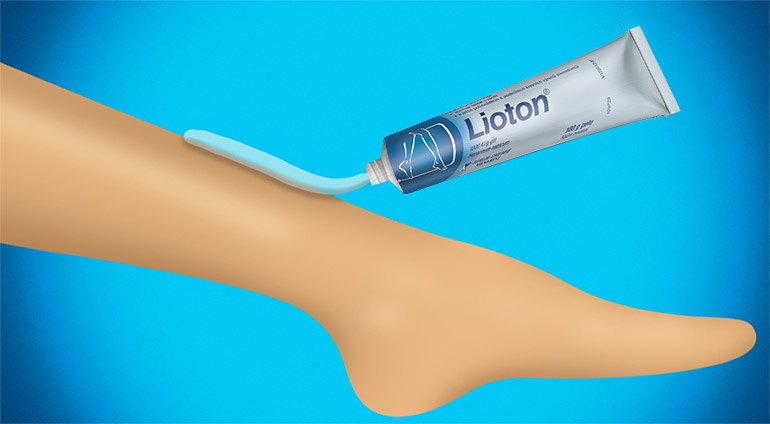 Použití přípravku Lioton® při pocitu těžkých nohou